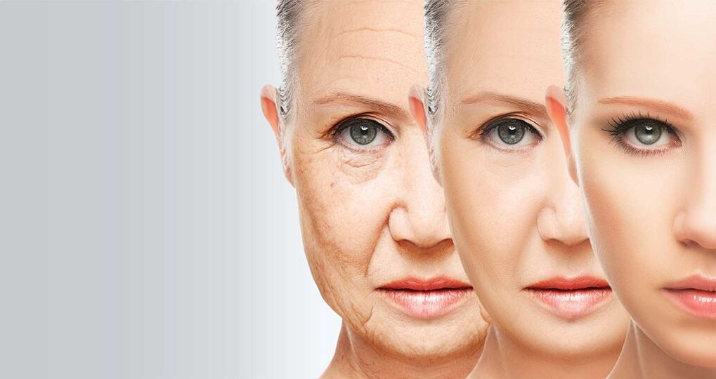 Facial rejuvenation with laser technology